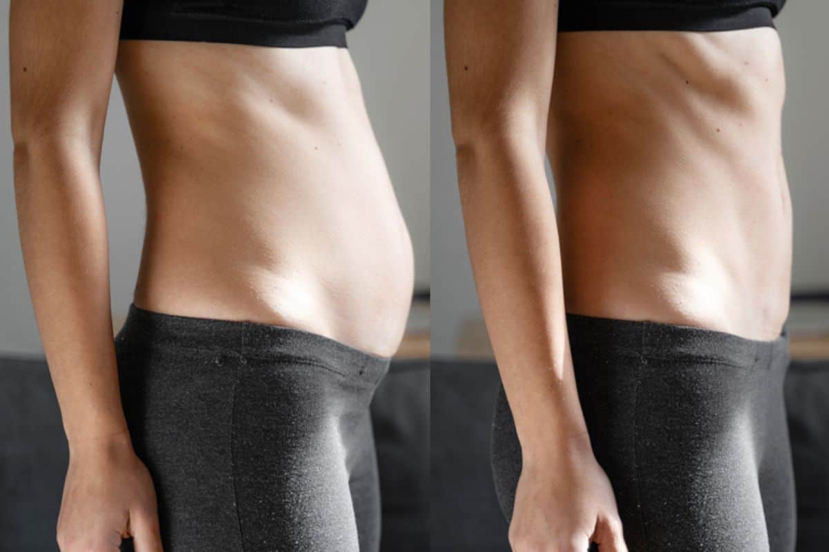 Post-Pregnancy: What Happens to Your Abdominal Muscles After Birth Abbots Langley