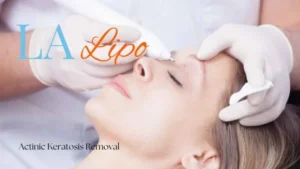 Woman receiving Actinic Keratosis Removal Treatment Abbots Langley