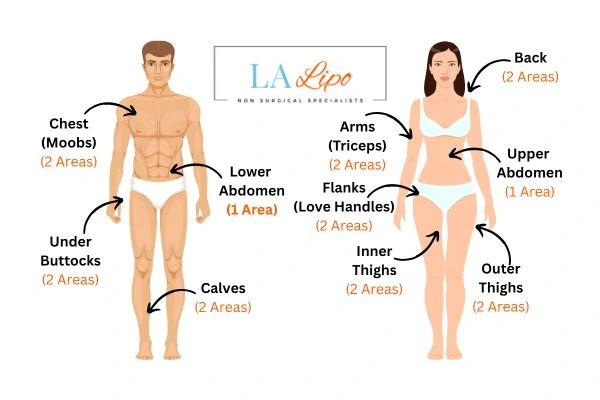 LA LIPO Cryolipolysis Areas Abbots Langley