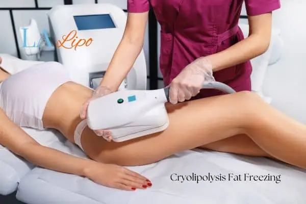 Woman receiving coolsculpting Abbots Langley treatment on her thighs