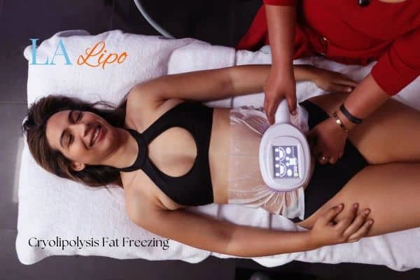 woman getting cryolipolysis Abbots Langley