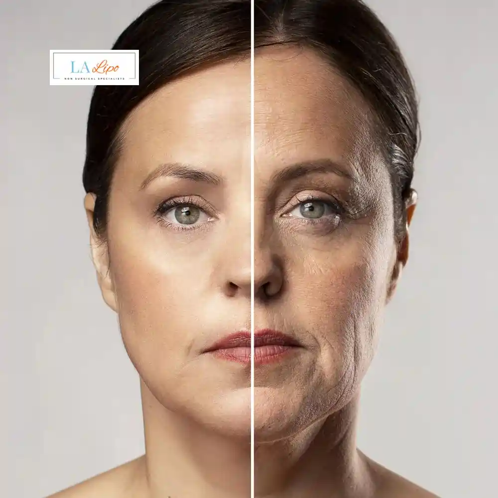 How Can You Tell If Non-Surgical Skin Tightening Is Right for You Abbots Langley?