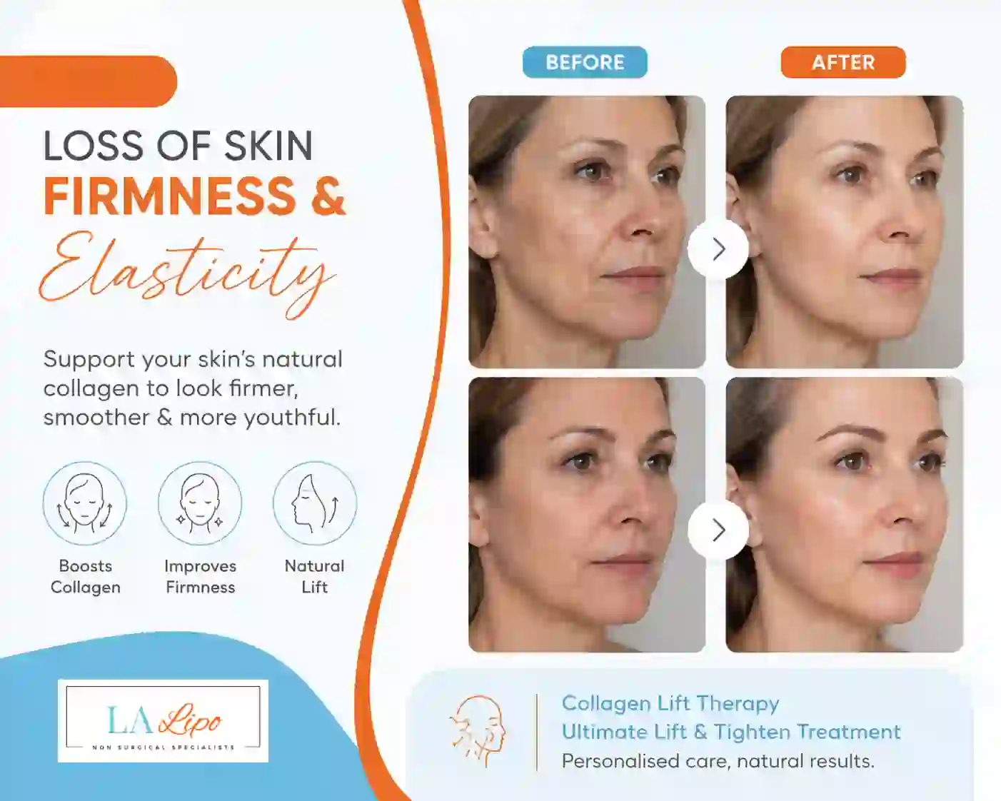 Sign #7: Loss of Skin Firmness and Elasticity Abbots Langley